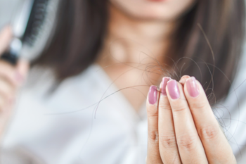Hair loss
