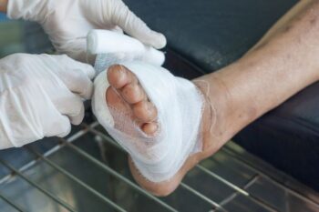 diabetic wound