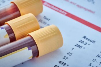 blood test and results